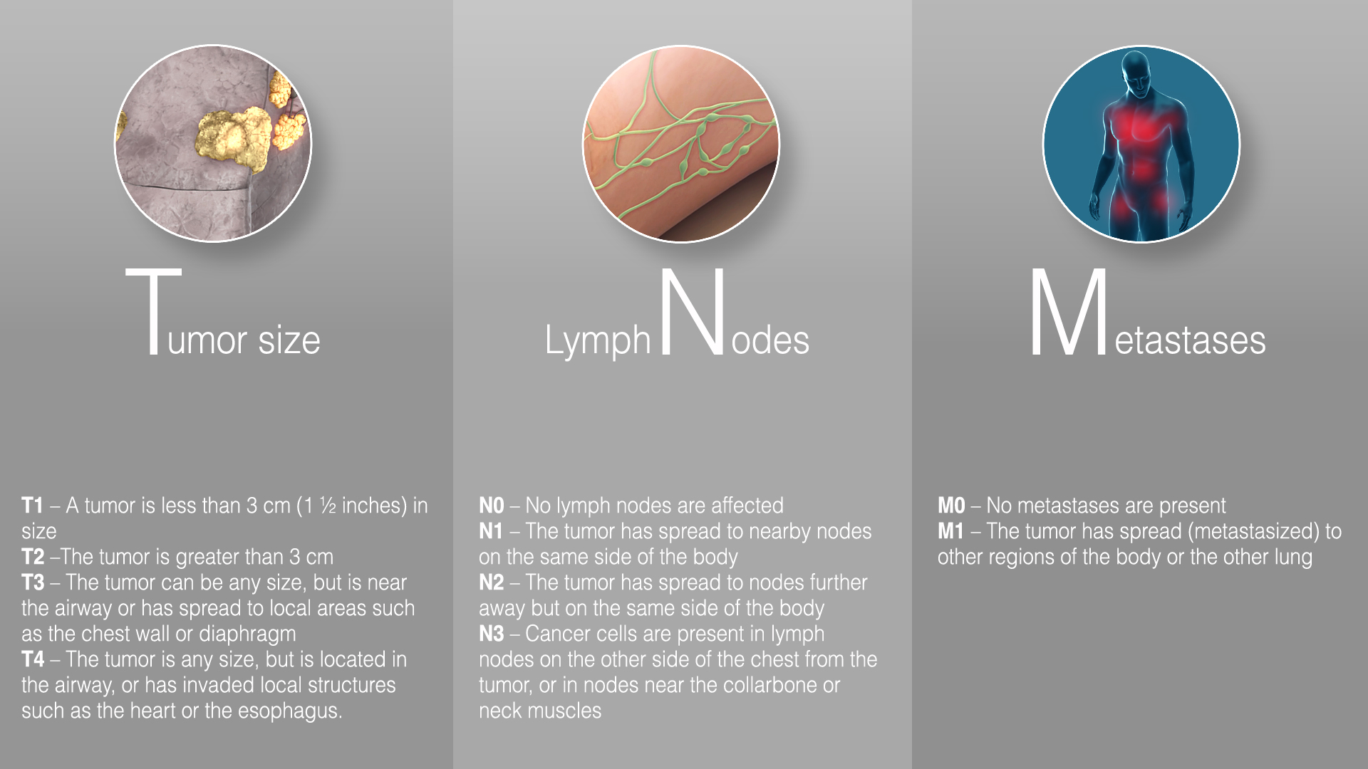 Breast Cancer Treatment Varies With Each Stage Scientific Animations