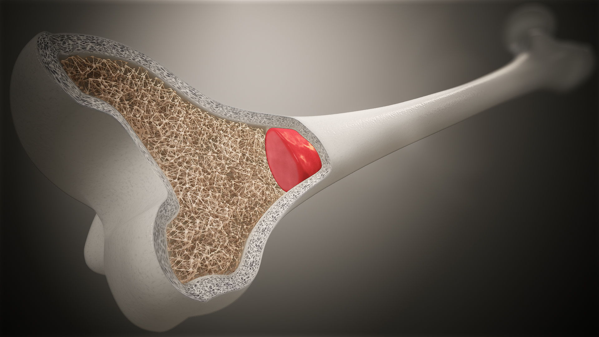 Functions And Conditions Of Bone Marrow Scientific Animations