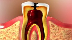 Dental X Rays Explained Through A Medical Animation