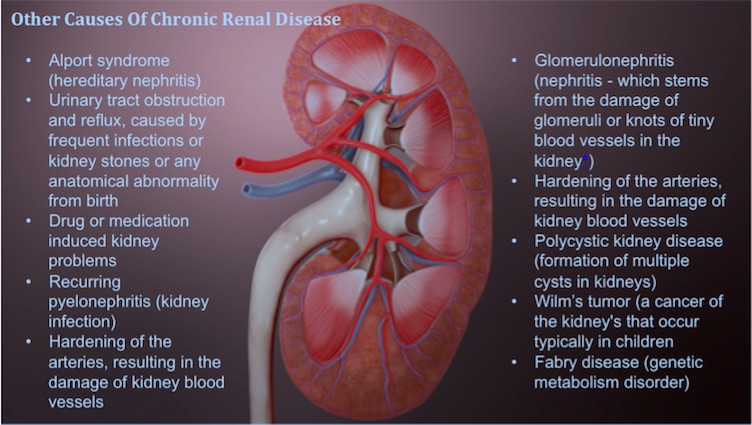 Renal Disease Causes Diabetes And Renal Failure Everything You Need 