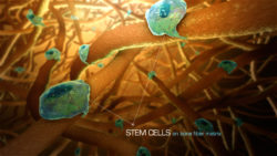 Bone regeneration using stem cells