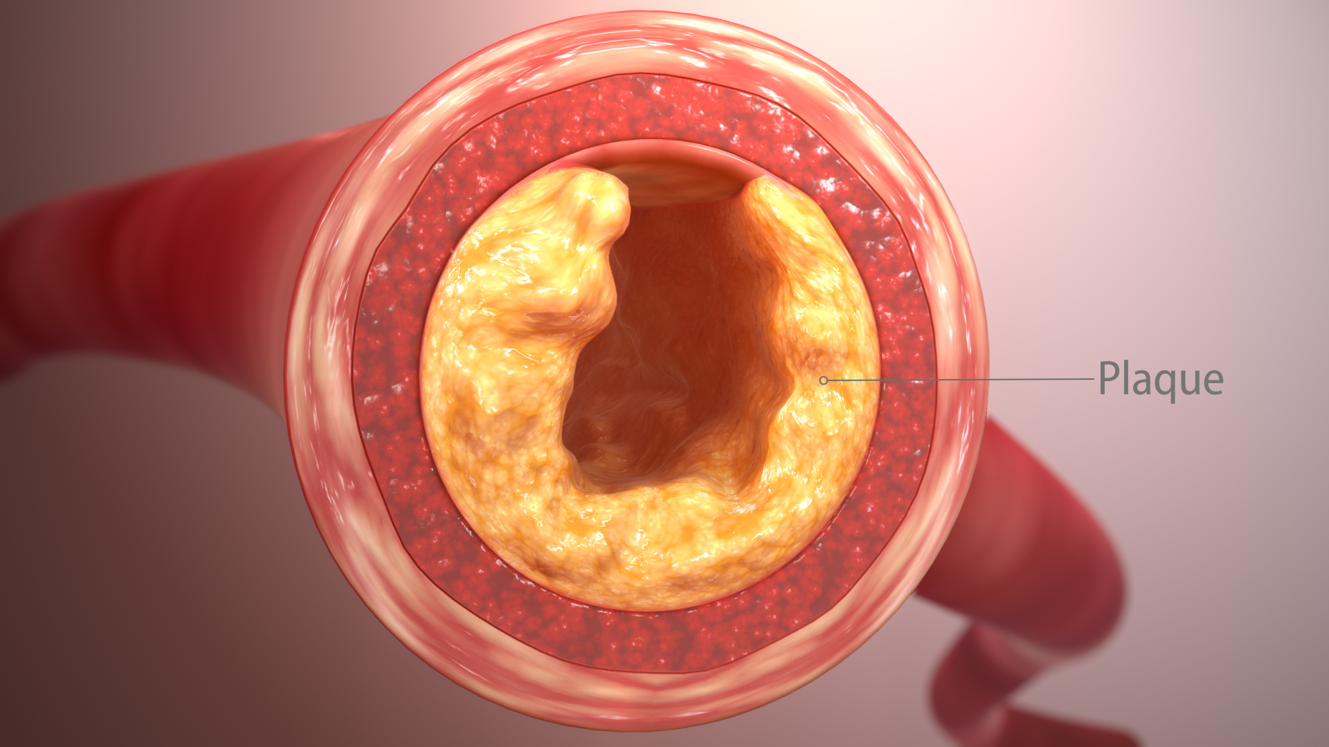 Myths And Facts About Cholesterol You Should Know