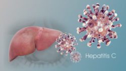 How is Hepatitis C infection different in Women