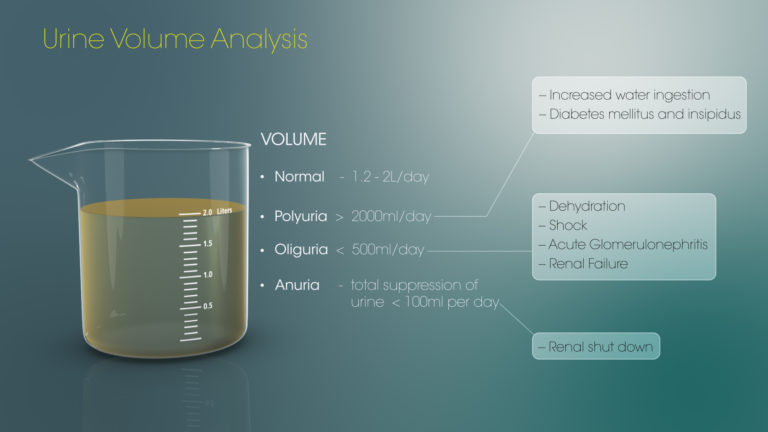 Urine Volume Analysis - Scientific Animations