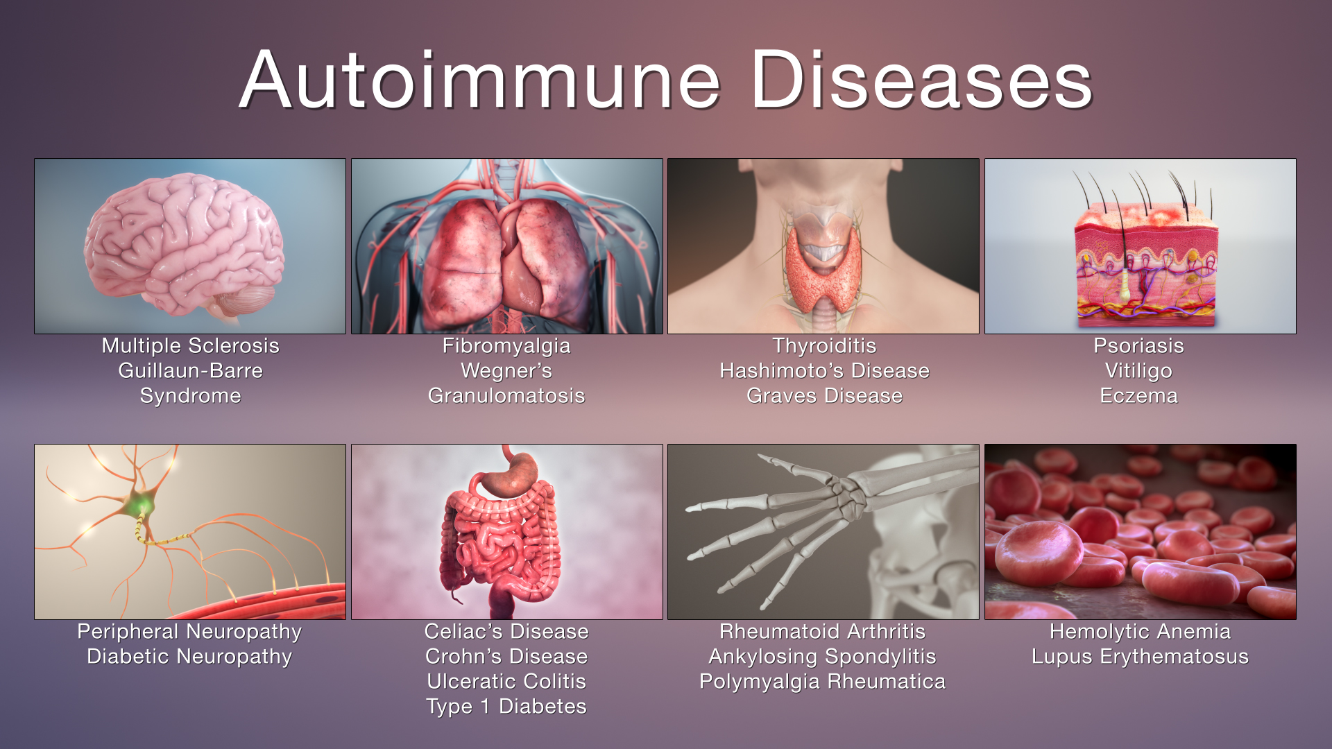 Autoimmune Diseases Symptoms And Treatments Scientific Animations 6204