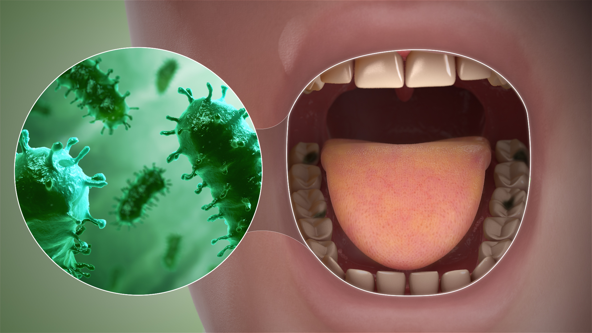 Bad Breath Symptoms Causes And Treatment Scientific Animations