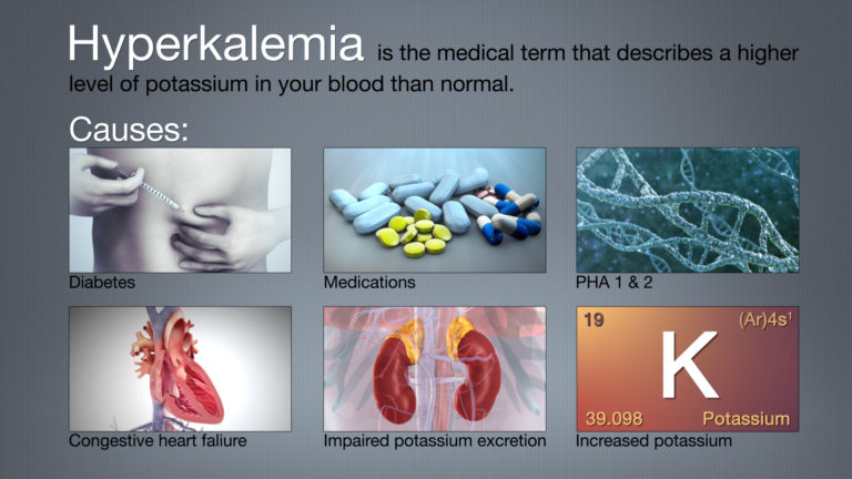 Hyperkalemia - Scientific Animations