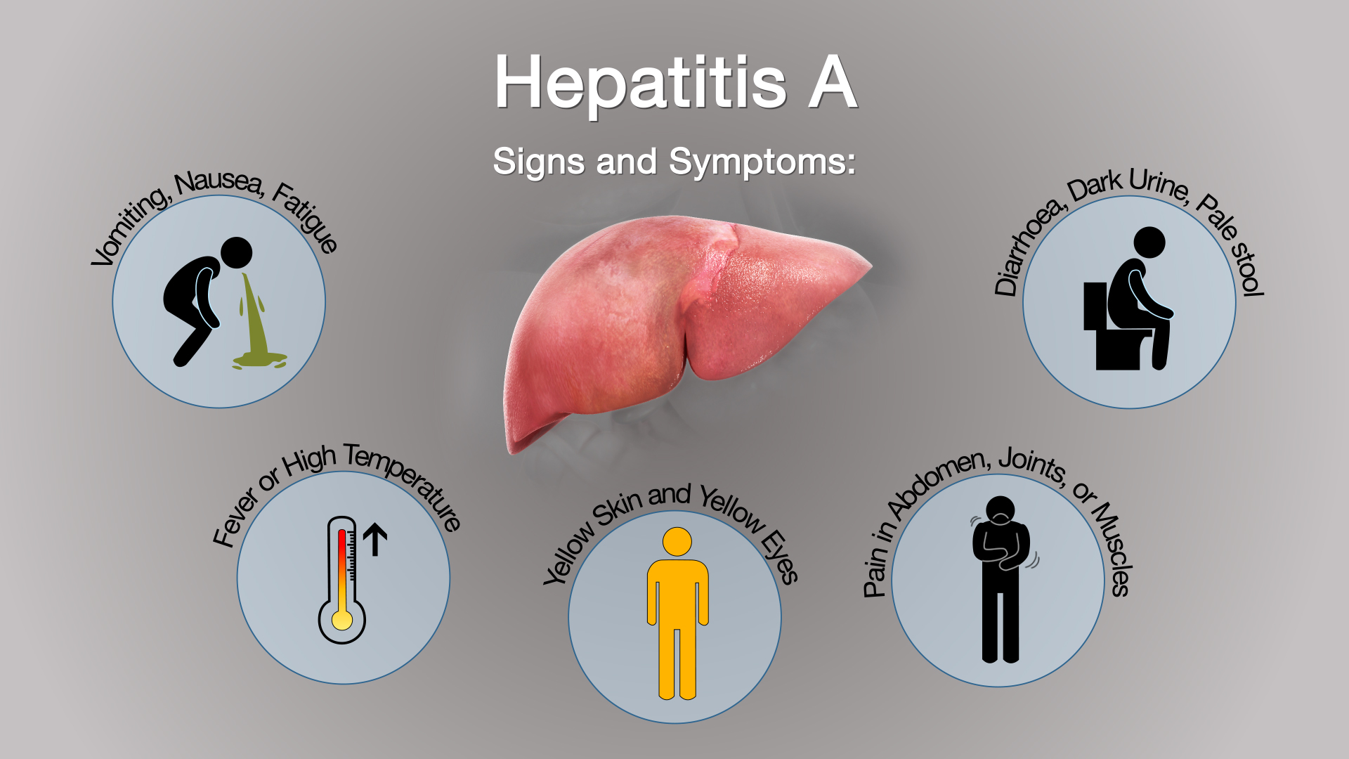 Hepatitis A: Symptoms, Causes, and Treatment - Scientific Animations