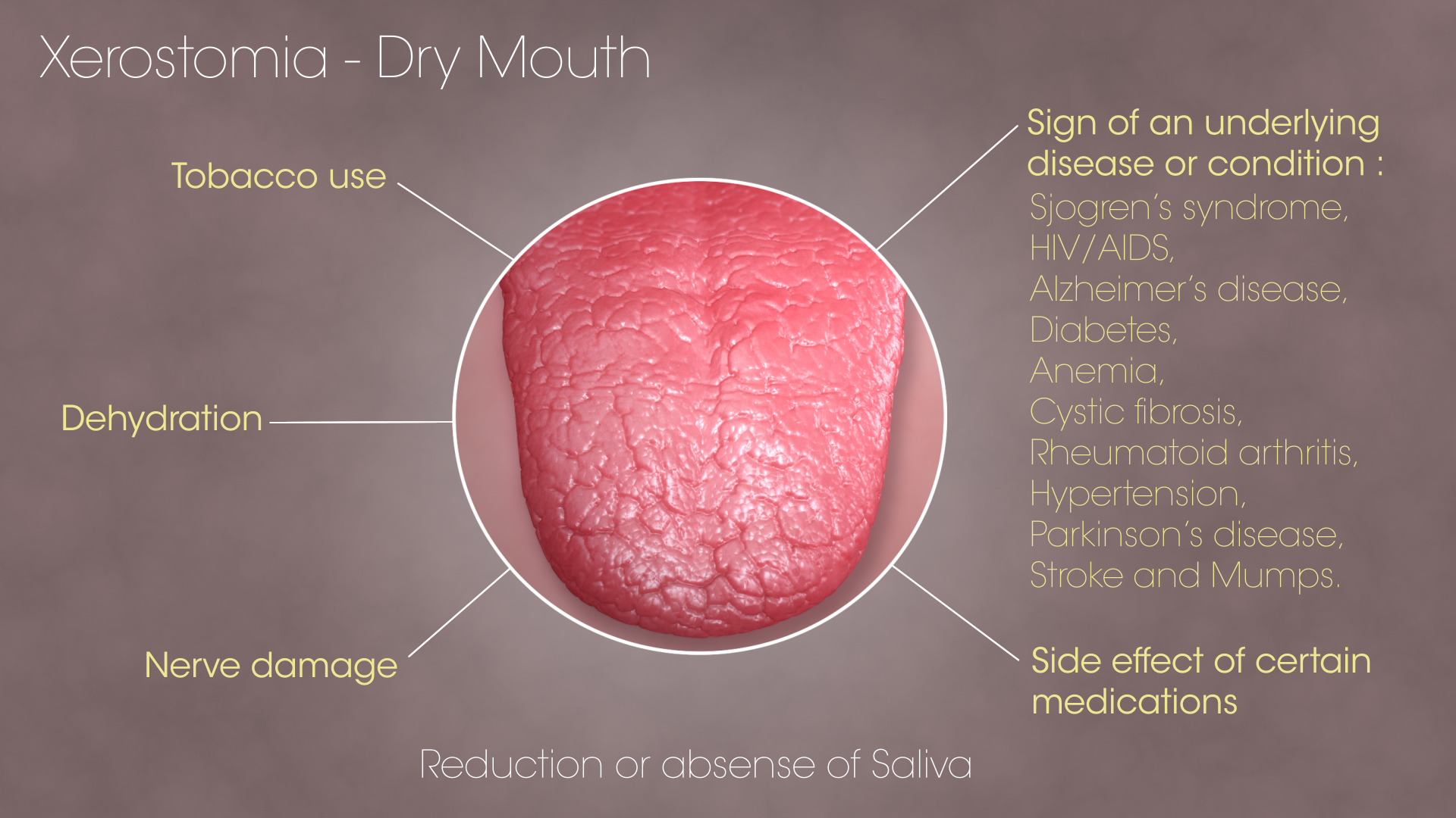 Dry mouth