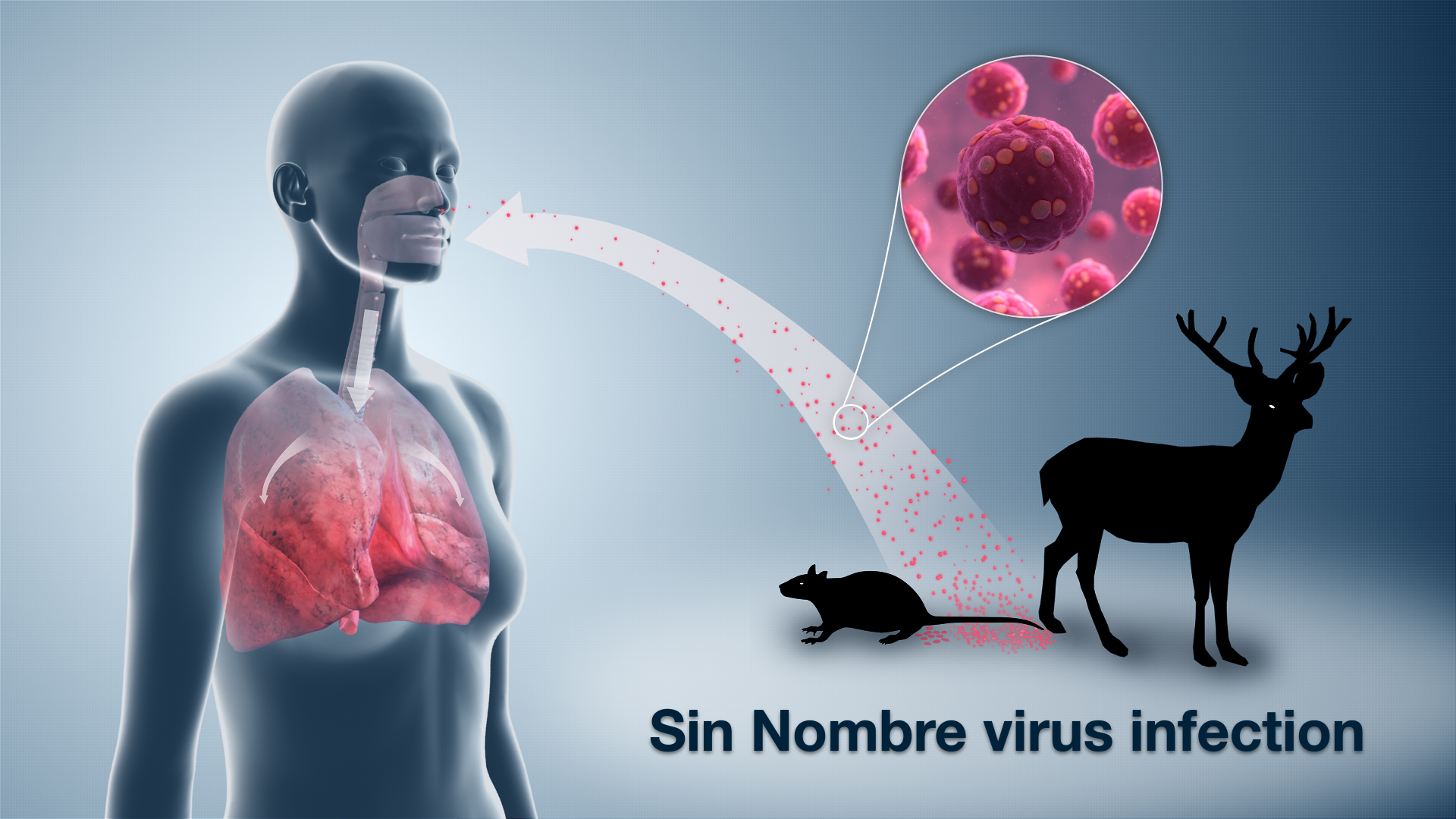 Medical Animation Still Shot Showing, transmission of Sin Nombre Virus From Rat